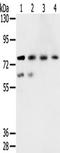 Transmembrane Serine Protease 7 antibody, TA349390, Origene, Western Blot image 