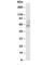 Checkpoint Kinase 2 antibody, R30302, NSJ Bioreagents, Western Blot image 