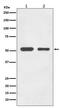 Tubulin Alpha 1b antibody, M08382, Boster Biological Technology, Western Blot image 