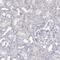 Ankyrin Repeat Domain 65 antibody, PA5-64240, Invitrogen Antibodies, Immunohistochemistry paraffin image 
