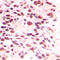 Ly1 Antibody Reactive antibody, LS-C353482, Lifespan Biosciences, Immunohistochemistry paraffin image 