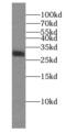 Regulating Synaptic Membrane Exocytosis 4 antibody, FNab07305, FineTest, Western Blot image 
