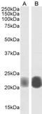 Caveolin 1 antibody, LS-B192, Lifespan Biosciences, Western Blot image 