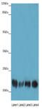 Abhydrolase Domain Containing 14B antibody, A57377-100, Epigentek, Western Blot image 