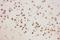 Arachidonate 5-Lipoxygenase antibody, LS-C357441, Lifespan Biosciences, Immunohistochemistry frozen image 