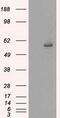 Cytochrome P450 Family 2 Subfamily E Member 1 antibody, GTX84634, GeneTex, Western Blot image 