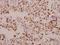 Core-Binding Factor Subunit Beta antibody, A01007-2, Boster Biological Technology, Immunohistochemistry frozen image 