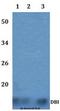 Diazepam Binding Inhibitor, Acyl-CoA Binding Protein antibody, LS-C411990, Lifespan Biosciences, Western Blot image 