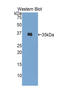 Insulin antibody, LS-C294635, Lifespan Biosciences, Western Blot image 