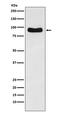 Outer Dense Fiber Of Sperm Tails 2 antibody, M05599, Boster Biological Technology, Western Blot image 