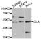 Galactosidase Alpha antibody, abx001425, Abbexa, Western Blot image 