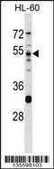 Serine Protease 16 antibody, 58-586, ProSci, Western Blot image 