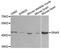 Guanine nucleotide-binding protein G(s) subunit alpha isoforms short antibody, A2732, ABclonal Technology, Western Blot image 