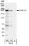 Centrosomal Protein 170 antibody, NB100-55317, Novus Biologicals, Western Blot image 