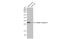 Troponin I3, Cardiac Type antibody, GTX109331, GeneTex, Western Blot image 