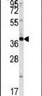 SH3 Domain Containing GRB2 Like, Endophilin B1 antibody, PA5-15278, Invitrogen Antibodies, Western Blot image 