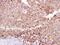 Caseinolytic Mitochondrial Matrix Peptidase Proteolytic Subunit antibody, GTX104656, GeneTex, Immunohistochemistry paraffin image 