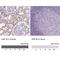 HNF1 Homeobox B antibody, NBP2-30678, Novus Biologicals, Immunohistochemistry paraffin image 