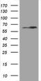 Heat Shock Protein Family D (Hsp60) Member 1 antibody, TA800771BM, Origene, Western Blot image 