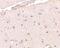 BRCA1/BRCA2-Containing Complex Subunit 3 antibody, A04690, Boster Biological Technology, Immunohistochemistry frozen image 