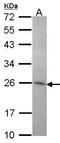 Syntaxin Binding Protein 6 antibody, NBP2-15376, Novus Biologicals, Western Blot image 