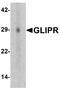 GLI Pathogenesis Related 1 antibody, A08471, Boster Biological Technology, Western Blot image 