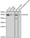 RAD23 Homolog A, Nucleotide Excision Repair Protein antibody, A3188, ABclonal Technology, Western Blot image 