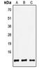 Defensin Beta 4B antibody, GTX56023, GeneTex, Western Blot image 