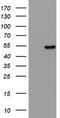 Keratin 20 antibody, LS-C336608, Lifespan Biosciences, Western Blot image 