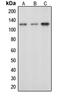 Cbl Proto-Oncogene antibody, MBS820886, MyBioSource, Western Blot image 