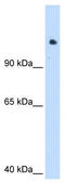 SWI/SNF Related, Matrix Associated, Actin Dependent Regulator Of Chromatin, Subfamily A Like 1 antibody, TA343719, Origene, Western Blot image 