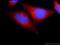 Caspase Recruitment Domain Family Member 11 antibody, 21741-1-AP, Proteintech Group, Immunofluorescence image 