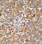 AlkB Homolog 3, Alpha-Ketoglutaratedependent Dioxygenase antibody, GTX81095, GeneTex, Immunohistochemistry paraffin image 