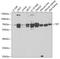 Transketolase antibody, GTX16442, GeneTex, Western Blot image 