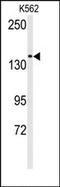 Transient Receptor Potential Cation Channel Subfamily M Member 7 antibody, AP14982PU-N, Origene, Western Blot image 