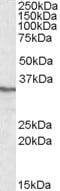 Protein Phosphatase 4 Catalytic Subunit antibody, MBS422199, MyBioSource, Western Blot image 