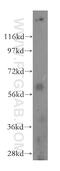 Protein Arginine Methyltransferase 3 antibody, 17628-1-AP, Proteintech Group, Western Blot image 