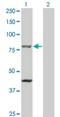 Transporter 1, ATP Binding Cassette Subfamily B Member antibody, H00006890-M01, Novus Biologicals, Western Blot image 