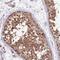 Adhesion Molecule With Ig Like Domain 1 antibody, NBP2-14287, Novus Biologicals, Immunohistochemistry frozen image 