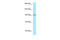 RAS Guanyl Releasing Protein 1 antibody, ARP63788_P050, Aviva Systems Biology, Western Blot image 