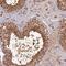 Radial Spoke Head 3 antibody, PA5-58658, Invitrogen Antibodies, Immunohistochemistry paraffin image 