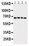 Calcium/Calmodulin Dependent Protein Kinase Kinase 2 antibody, PA1497, Boster Biological Technology, Western Blot image 