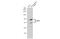 Forkhead Box P1 antibody, GTX133394, GeneTex, Western Blot image 