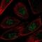 Fibroblasts antibody, NBP1-87971, Novus Biologicals, Immunofluorescence image 