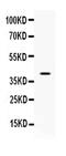 CD48 Molecule antibody, PA5-78988, Invitrogen Antibodies, Western Blot image 