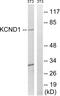 Potassium Voltage-Gated Channel Subfamily D Member 1 antibody, abx014730, Abbexa, Western Blot image 