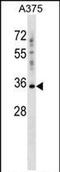 Pregnancy Specific Beta-1-Glycoprotein 2 antibody, PA5-71976, Invitrogen Antibodies, Western Blot image 