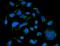 Golgi Reassembly Stacking Protein 1 antibody, A05896-2, Boster Biological Technology, Immunofluorescence image 