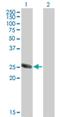 Testis Specific Serine Kinase 3 antibody, H00081629-M07, Novus Biologicals, Western Blot image 