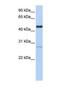 Nuclear Receptor Subfamily 2 Group F Member 1 antibody, NBP1-52831, Novus Biologicals, Western Blot image 